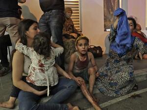 Wounded people wait to received help outside a hospital following an explosion in the Lebanese capital Beirut on August 4, 2020. IBRAHIM AMRO / AFP