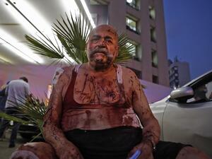 A wounded man receives help outside a hospital following an explosion in the Lebanese capital Beirut on August 4, 2020. Two huge explosion rocked the Lebanese capital Beirut, wounding dozens of people, shaking buildings and sending huge plumes of smoke billowing into the sky. Lebanese media carried images of people trapped under rubble, some bloodied, after the massive explosions, the cause of which was not immediately known.  IBRAHIM AMRO / AFP