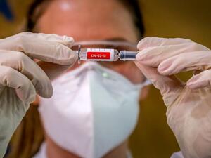 The vaccine trial is being carried out in Brazil in partnership with Brazilian Research Institute Butanta. SILVIO AVILA / AFP