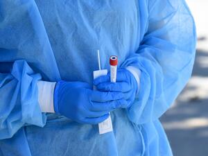 Mend Urgent Care workers wearing personal protective equipment perform drive-up COVID-19 testing at James Jordan Middle School on August 10, 2020 in Winnetka, California. The coronavirus pandemic spread quickly throughout the state, as California continues to lead the nation in number of cases. Kevin Winter/Getty Images/AFP KEVIN WINTER / GETTY IMAGES NORTH AMERICA / Getty Images via AFP