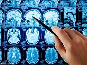 (Shutterstock/ File Photo)