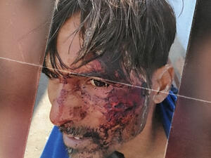 Social media people described the acts as inhumane, disturbing and inacceptable. 