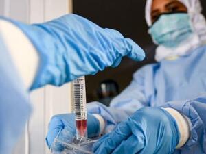 الوضع الوبائي في الأردن خطير جدا