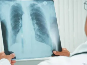 يساعد الحفاظ على رطوبة الجسم في التخلص من البلغم والمخاط السميك
