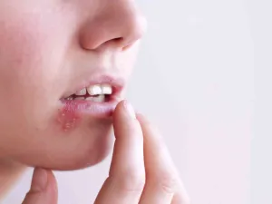 ممارسة الجنس المهبلي أو الشرجي دون استخدام حاجز حماية