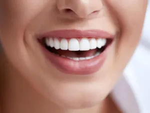  هناك تقنية لتبييض الأسنان من خلال الضوء، وهذه التقنية وقفت في الخارج