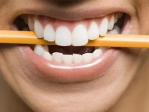 ويمكن أن يؤدي امتلاك شخصية "تنافسية أو عدوانية أو مفرطة النشاط" إلى زيادة خطر الإصابة بصرير الأسنان