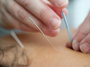 تفسير الحلم بالعلاج بالإبر في المنام؟