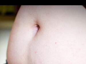 تفسير رؤية سرة البطن في المنام؟