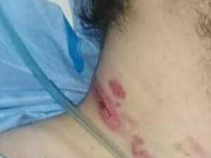 الفتى المعتدى عليه