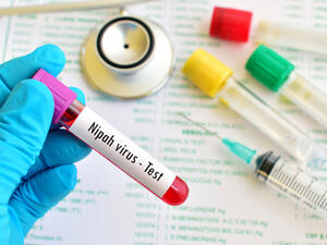 Nipah Virus. (Shutterstock/ File Photo)