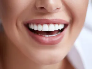 ينتج تغير لون الأسنان في الغالب عن تراكم البلاك، يمكن أن يساعد التنظيف المنتظم بالفرشاة