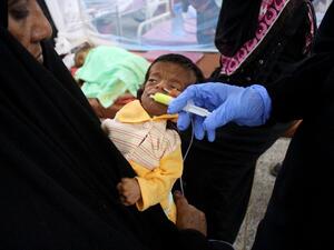 Children hit hardest in the Yemeni war 
