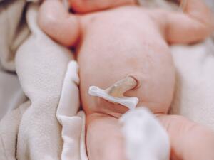 الحلم بالحبل السري في المنام