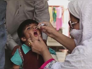 شلل الأطفال