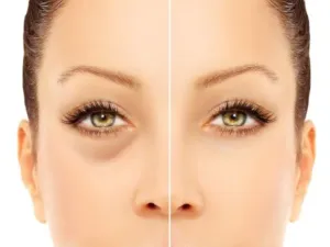 استخدام مستحضرات التجميل. إذا كنتِ ترغبين في إخفاء الهالات أسفل العين