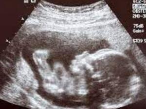 ما تفسير الحلم بجهاز الموجات فوق الصوتية في المنام؟