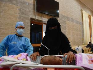 Yemeni conjoined twins Yousef and Yassin arrived to Riyadh 