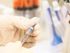 ما تفسير الحلم بشد الوجه في المنام؟