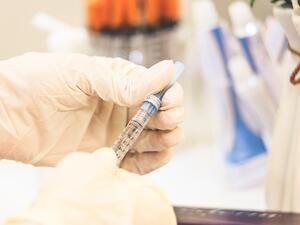 ما تفسير الحلم بشد الوجه في المنام؟