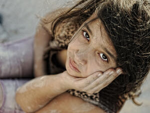 Poverty and poorness on the children face