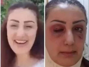 رنا علي