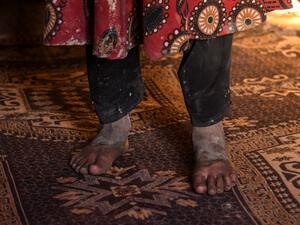 UN agencies say almost 23 million in Afghanistan face hunger this winter