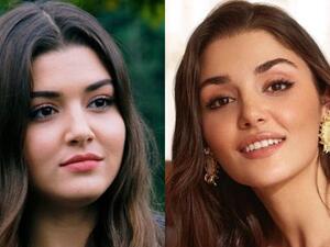 Hande Erçel's Plastic Surgeries Put Her in Trouble After Being Named the Most Beautiful Woman in the World