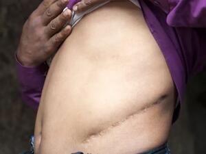 البت بأكبر قضايا الإتجار بالبشر وبيع الأعضاء بمصر