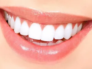 كل ما تريد معرفته عن قشور الأسنان قبل الحصول عليها