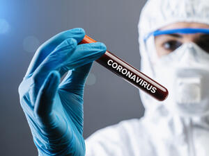 COVID-19 cases spike to more than 170,000
