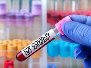 Antibodies from COVID-19 infection may last up to 20 months