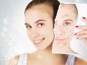 جميلة البوابة: 5 نصائح من الأيورفيدا لبشرة شابة