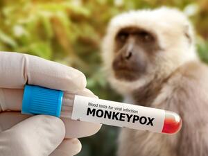 monkeypox