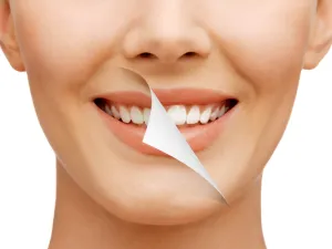 تنظيف الأسنان عند الطبيب بانتظام..الإيجابيات والسلبيات