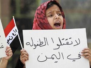 منظمة: الأطفال اليمنيون ما زالوا يموتون من الجوع