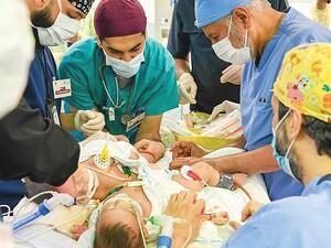 فصل التوأم اليمني مودة ورحمة 