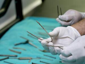 استخراج 158 قطعة معدنية من معدة امرأة