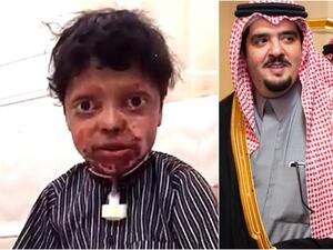 الأمير عبد العزيز بن فهد مع الطفل دحوم