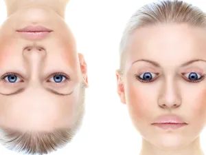 مرض عمى الوجوه أعراضه وأسبابه
