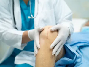 الجدول الزمني للتعافي من جراحة استبدال الركبة