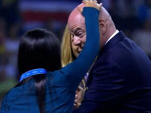 "صلعة" انفاتينو تجذب لاعبات البرازيل في مونديال الناشئات