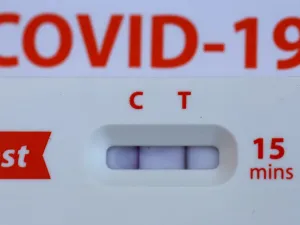 A positive Covid-19 at home test is displayed on May 02, 2022 in San Anselmo, California. (Photo Illustration by Justin Sullivan/Getty Images) (Photo by JUSTIN SULLIVAN / GETTY IMAGES NORTH AMERICA / Getty Images via AFP)