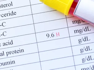 طبيب البوابة: لماذا يجب ألا تتجاهل التورم المؤلم في مفاصلك