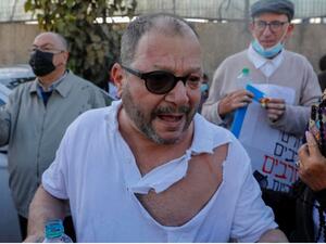 الشرطة الاسرائيلية كسرت نظارة كاسيف ومزقت قميصه خلال تضامنه مع اهالي حي الشيخ جراح