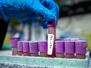 Data From QF’s Qatar Genome Programme Improves Breast Cancer Screening