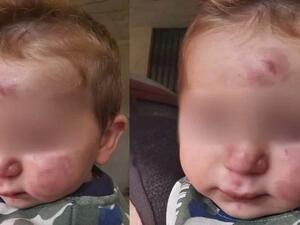 ضرب رضيع في حضانة يشعل الشارع اللبناني