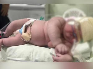 ولادة طفل ضخم في البرازيل