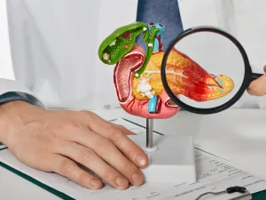 طبيب البوابة: أعراض سرطان القناة الصفراوية والعلاج