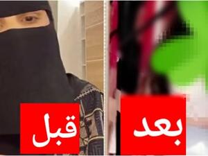 زهور سعود قبل وبعد